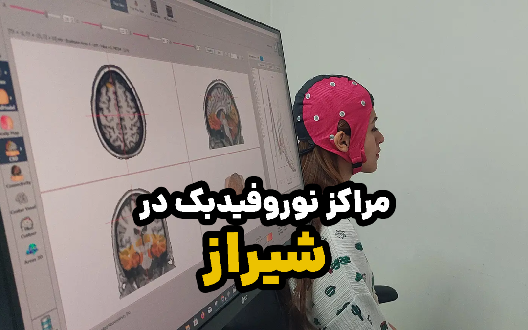 5 تا از بهترین مراکز نوروفیدبک در شیراز
