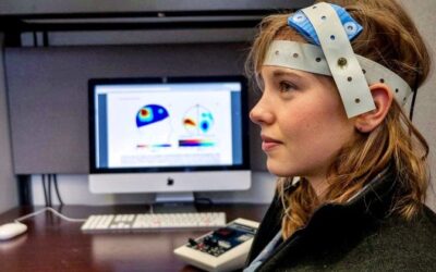 تحریک الکتریکی مغز در شیراز : tDCS چیست؟