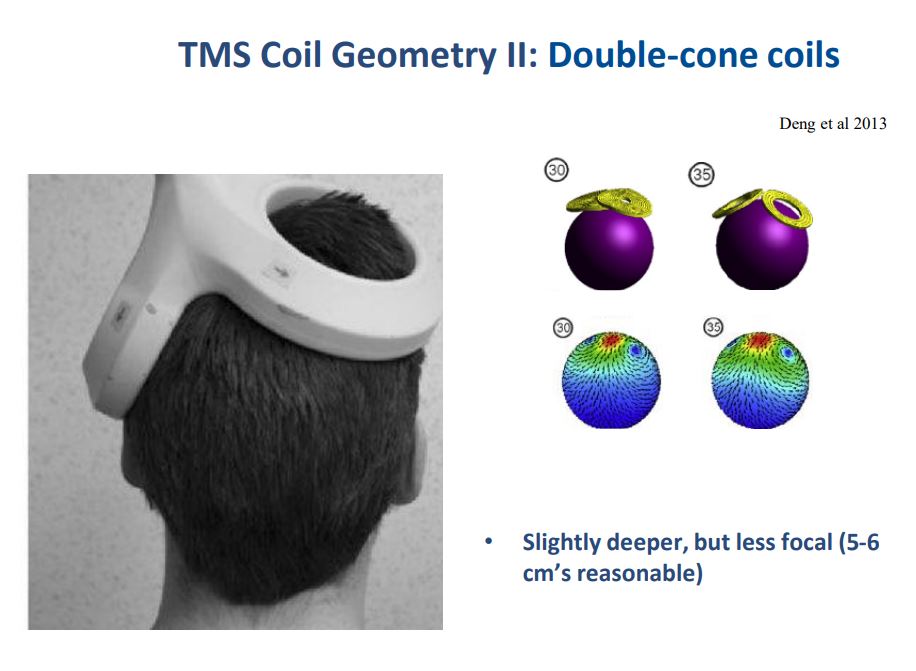 راهنمای کامل درمان با تحریک مغناطیسی مغز TMS/rTMS 4 راهنمای کامل درمان با تحریک مغناطیسی مغز TMS/rTMS | سلامت مغز | دکتر علی محمد کمالی (PhD in Neuroscience) | 3