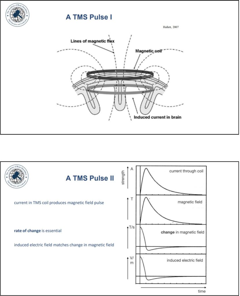 راهنمای کامل درمان با تحریک مغناطیسی مغز TMS/rTMS 1 پالس rTMS چطور کار میکنه