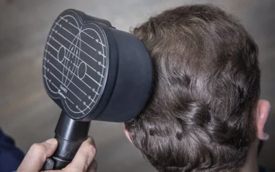 درمان میگرن با TMS در شیراز: خداحافظی با سردردهای مزمن بدون دارو