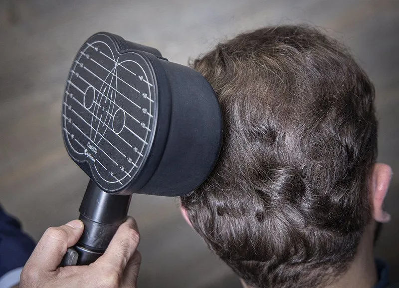 درمان میگرن با TMS در شیراز: خداحافظی با سردردهای مزمن بدون دارو